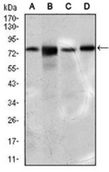 FATP5 Mouse Monoclonal Antibody