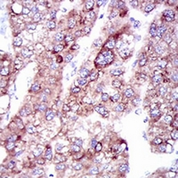 FATP5 Mouse Monoclonal Antibody