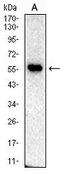 SLC22A12 Mouse Monoclonal Antibody