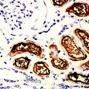 SLC22A12 Mouse Monoclonal Antibody
