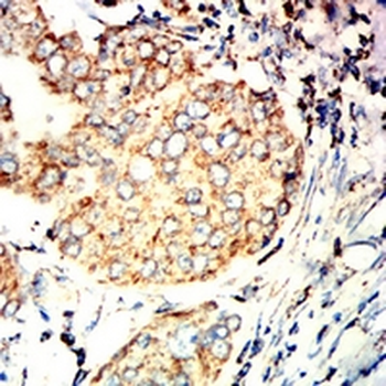 CD319 Mouse Monoclonal Antibody