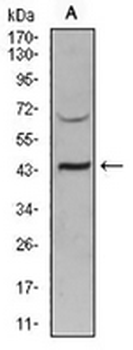 SIRT3 Mouse Monoclonal Antibody