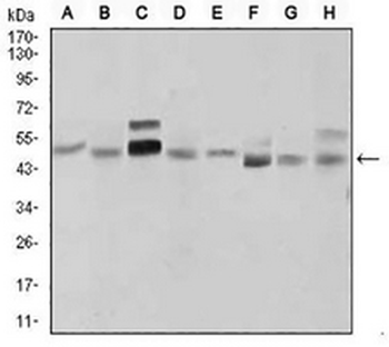 SHH Mouse Monoclonal Antibody