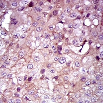 SHH Mouse Monoclonal Antibody