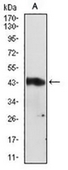 Serpin A3 Mouse Monoclonal Antibody