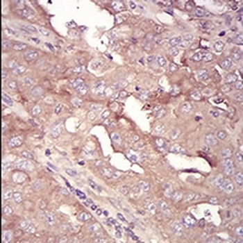 Serpin A3 Mouse Monoclonal Antibody