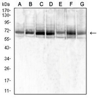 SDHA Mouse Monoclonal Antibody
