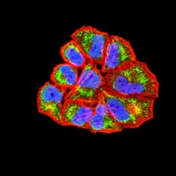 SDHA Mouse Monoclonal Antibody