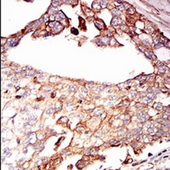 CD138 Mouse Monoclonal Antibody