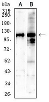 SALL4 Mouse Monoclonal Antibody