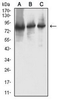 RRM1 Mouse Monoclonal Antibody