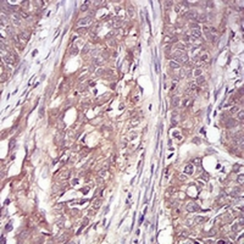 RSK3 Mouse Monoclonal Antibody