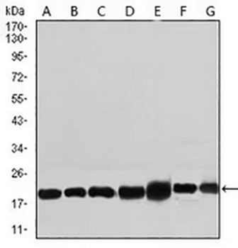 RPL18A Mouse Monoclonal Antibody