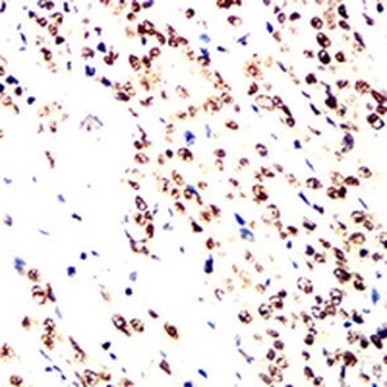 RPA2 Mouse Monoclonal Antibody