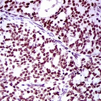 RING1 Mouse Monoclonal Antibody