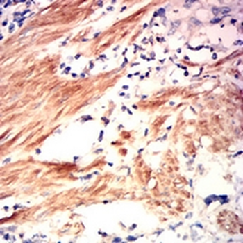 RhoA Mouse Monoclonal Antibody
