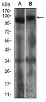 RB1 Mouse Monoclonal Antibody