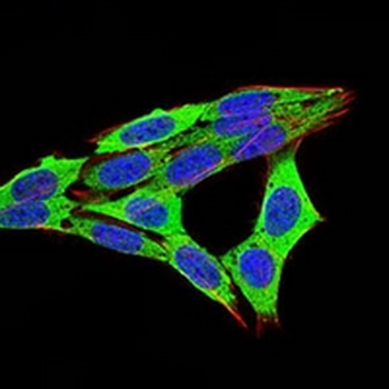 RB1 Mouse Monoclonal Antibody
