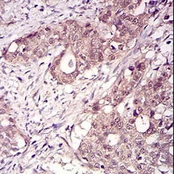 RANBP9 Mouse Monoclonal Antibody