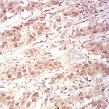 RAN Mouse Monoclonal Antibody