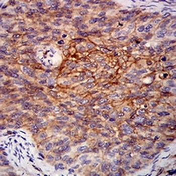 RALB Mouse Monoclonal Antibody