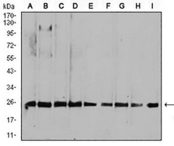 RALA Mouse Monoclonal Antibody