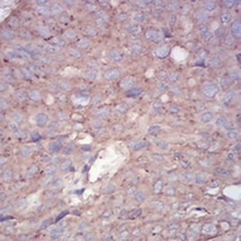 RALA Mouse Monoclonal Antibody