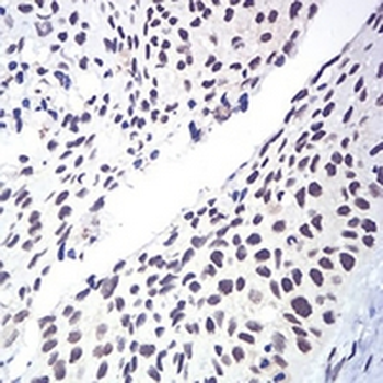 RAD50 Mouse Monoclonal Antibody