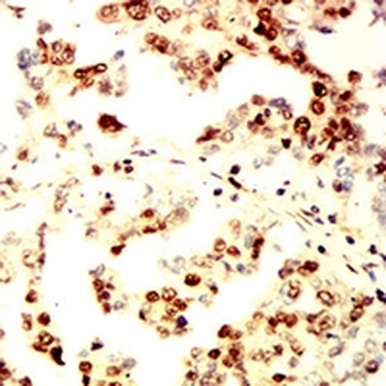 RAD23B Mouse Monoclonal Antibody