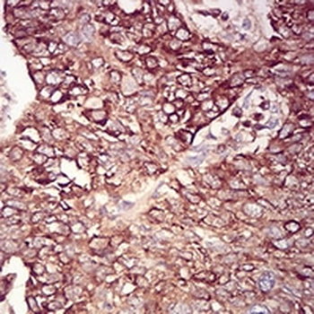 RAB6B Mouse Monoclonal Antibody