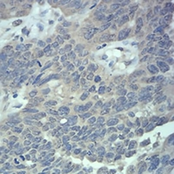 RAB5A Mouse Monoclonal Antibody
