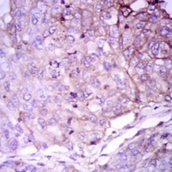 Rab 4A Mouse Monoclonal Antibody