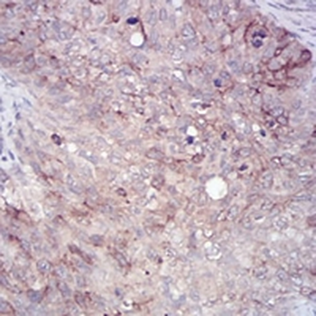 RAB11FIP1 Mouse Monoclonal Antibody