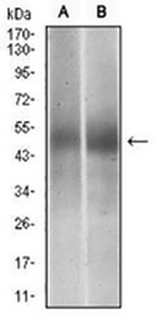 PTP1B Mouse Monoclonal Antibody