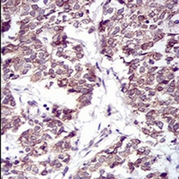 PTP1B Mouse Monoclonal Antibody