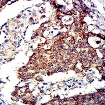 AMPK alpha 2 Mouse Monoclonal Antibody