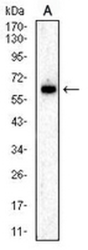 Perforin 1 Mouse Monoclonal Antibody