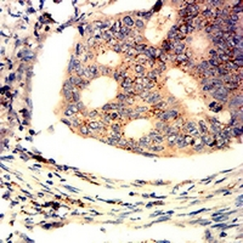 Perforin 1 Mouse Monoclonal Antibody