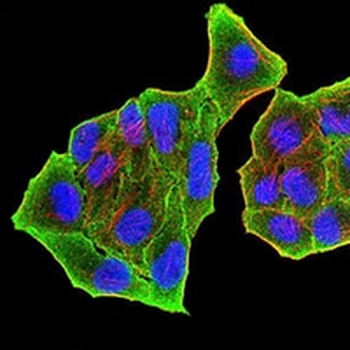 PRDM5 Mouse Monoclonal Antibody