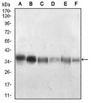PP1 beta Mouse Monoclonal Antibody