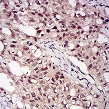 PP1 beta Mouse Monoclonal Antibody