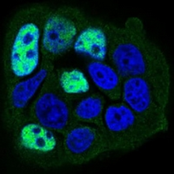 PP1 beta Mouse Monoclonal Antibody