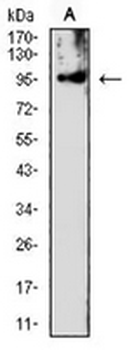 PMS2 Mouse Monoclonal Antibody