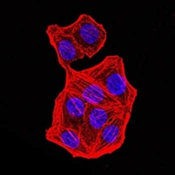 PMS2 Mouse Monoclonal Antibody