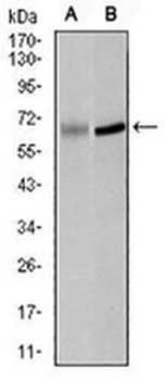 PLK1 Mouse Monoclonal Antibody