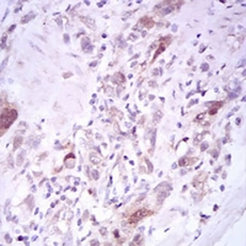 PLK1 Mouse Monoclonal Antibody