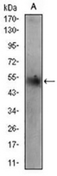 Adipophilin Mouse Monoclonal Antibody