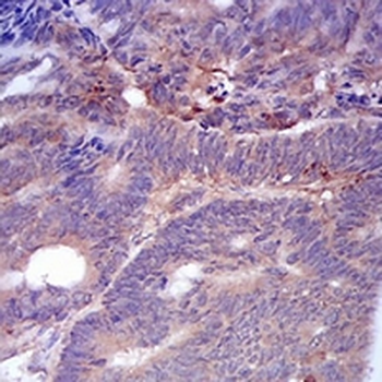 Adipophilin Mouse Monoclonal Antibody