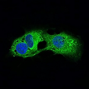 Adipophilin Mouse Monoclonal Antibody