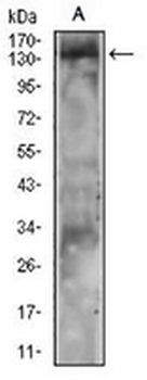 PLC gamma 2 Mouse Monoclonal Antibody